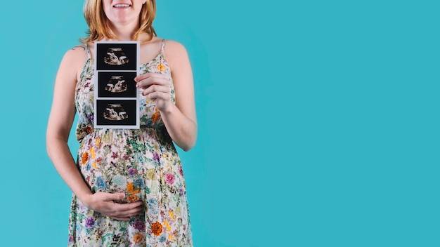 Ciąża bliźniacza kiedy wykryta przez lekarza?