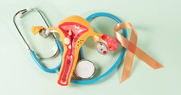 Co to jest torbiel krwotoczna na jajniku i jak się objawia?